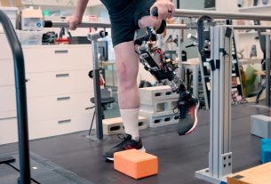 Bionic Limb Technology Advances Connecting Prosthetics Directly to Nervous System