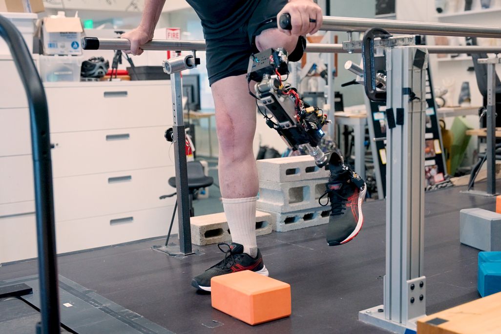 Bionic Limb Technology Advances Connecting Prosthetics Directly to Nervous System